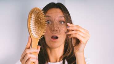A woman with hair loss and a comb representing hair loss and baldness problems