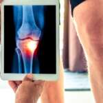 A doctor holds and examines an x-ray picture of the patient's leg bones for the diagnosis of osteoarthritis