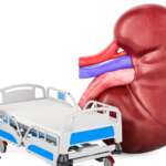 a hospital bed and chronic kidney disease with kidney failure concept