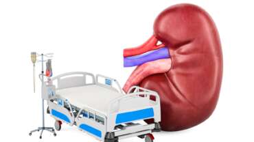 a hospital bed and chronic kidney disease with kidney failure concept