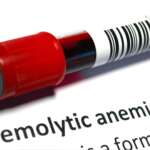 sample blood of sick humans from hemolytic anemia