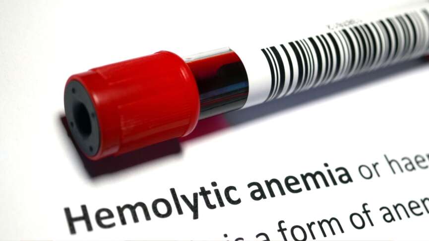 sample blood of sick humans from hemolytic anemia