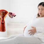 pregnant woman with her stomach due to endometriosis pain