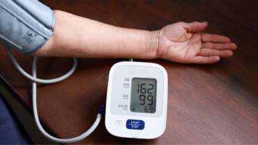 A man's arm with a device for taking blood pressure reading, machine showing high blood pressure of patient