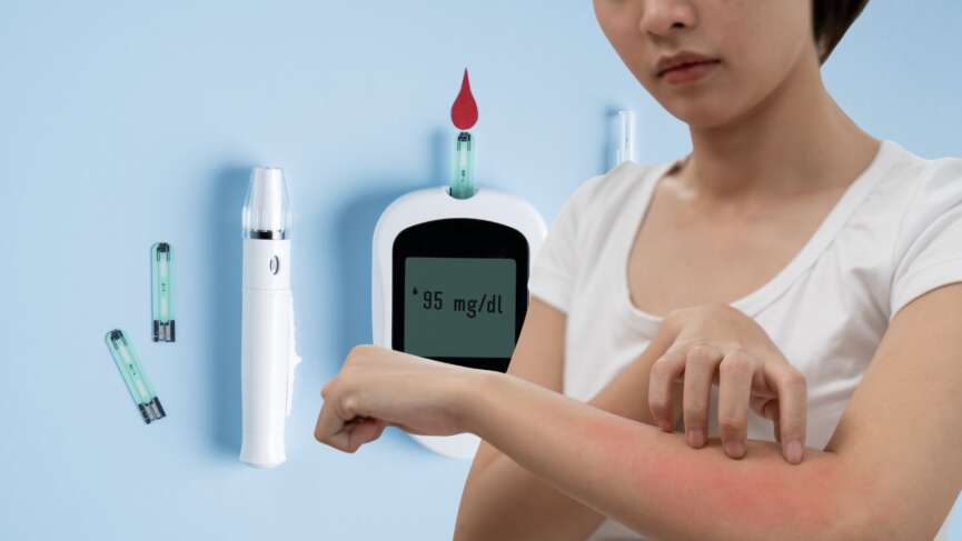 skin signs of diabetes