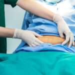 patient is laying on a bed in the doctor's office while doctor palping his stomach for percutaneous nephrolithotomy treatment
