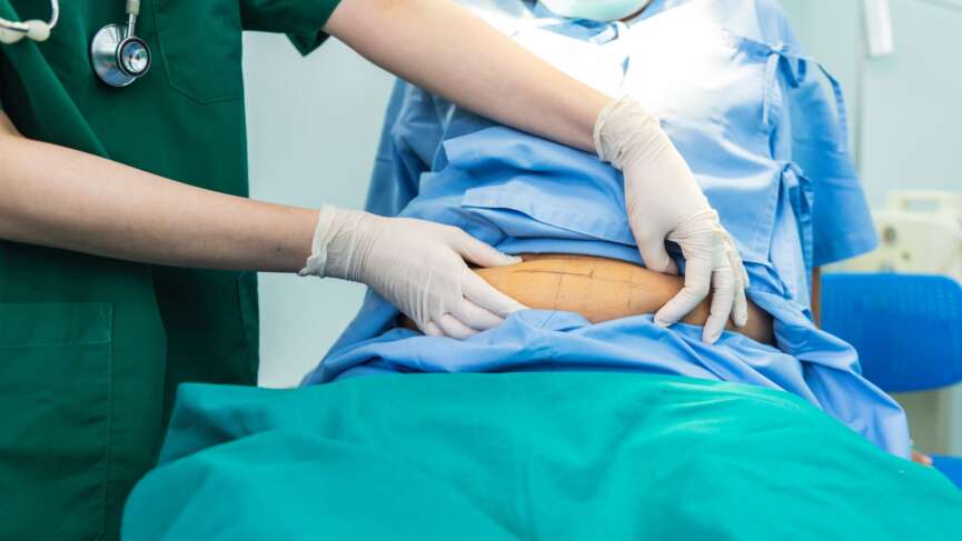patient is laying on a bed in the doctor's office while doctor palping his stomach for percutaneous nephrolithotomy treatment