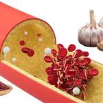medical infographic with garlic and red yeast rice for lowering cholesterol