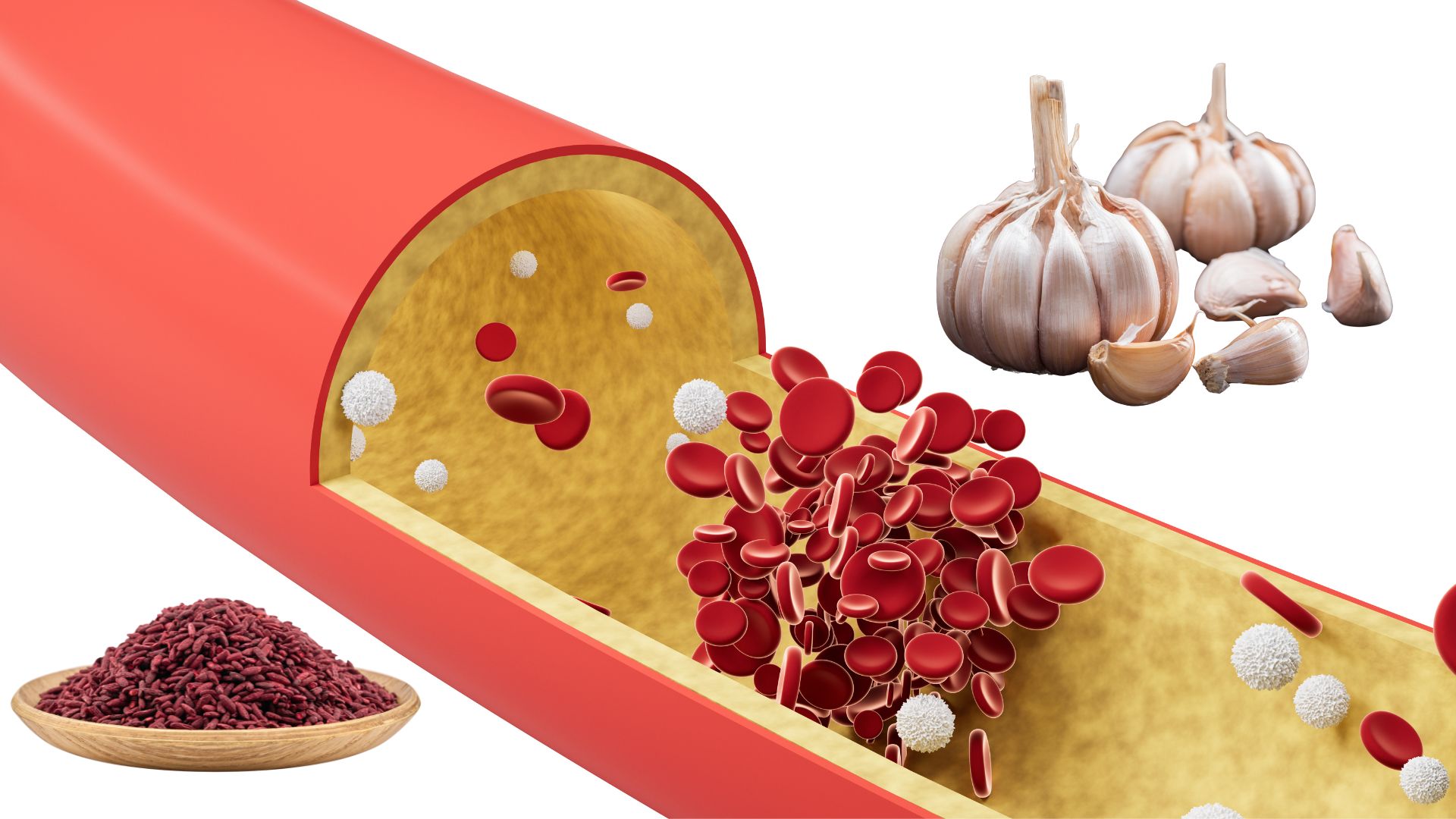 medical infographic with garlic and red yeast rice for lowering cholesterol