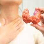 woman with thyroid gland human anatomy model representing the causes of hyperthyroidism