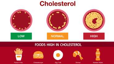 Cholesterol in artery health risk vector design, foods high in cholesterol and representing the signs of cholesterol