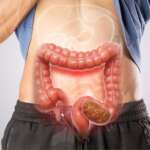 Young person with abdominal pain and constipation, illustrating the use of bulk-forming laxatives to relieve constipation and improve bowel movement
