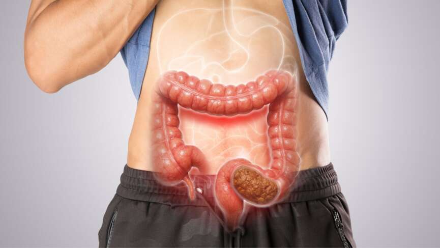 Young person with abdominal pain and constipation, illustrating the use of bulk-forming laxatives to relieve constipation and improve bowel movement