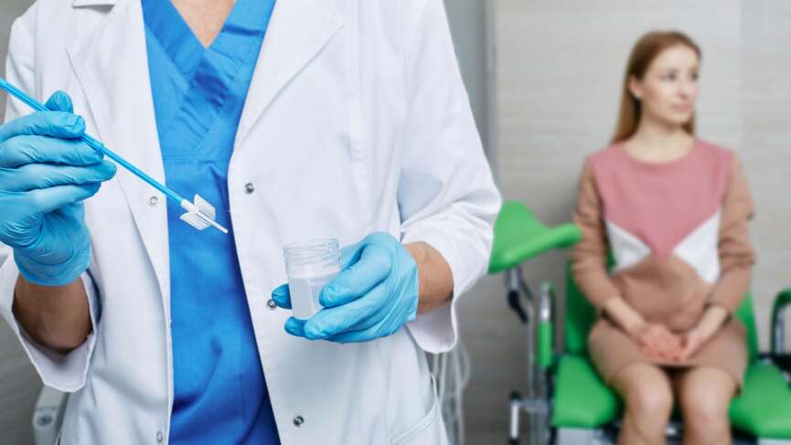A gynecologist collects a pap smear sample for cervical cancer screening test