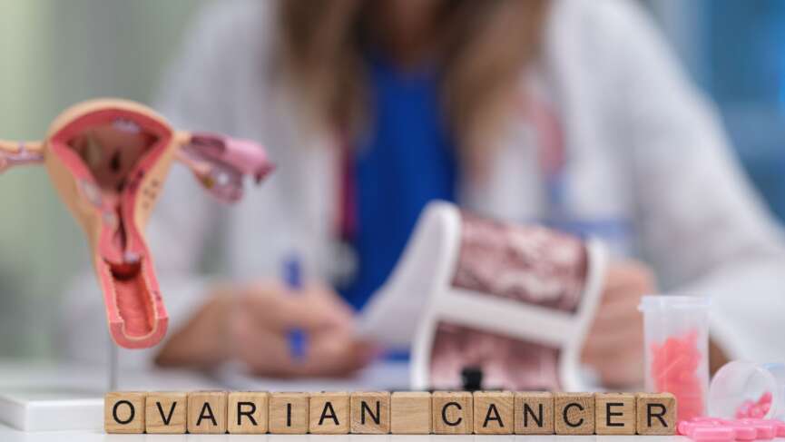 doctor holding anatomic model of ovary for presenting the signs of ovarian cancer
