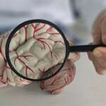 A doctor using lens to see a close-up of the human brain as the signs of stroke
