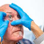 Ophthalmologist applying an eye opener on a senior patient for glacoma checkup and treatment