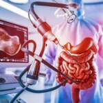 Medical technology with an endoscope with a monitor displays the intestine. Colonoscopy for Iron Deficiency concept