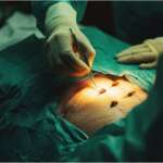 Doctors performing an gallbladder surgery concept