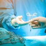 circumcision in men