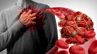 medical illustration of organ rejection concept of a young heart