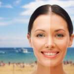 close up of beautiful smiling woman with half face tanned over exotic tropical beach with bungalow background; concept - SPF 30 vs. SPF 100