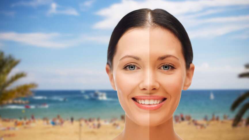 close up of beautiful smiling woman with half face tanned over exotic tropical beach with bungalow background; concept - SPF 30 vs. SPF 100