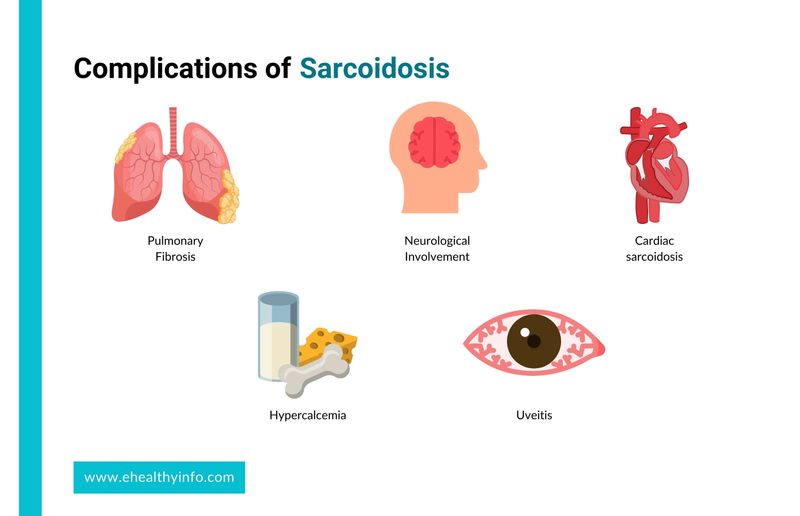complications of sarcoidosis