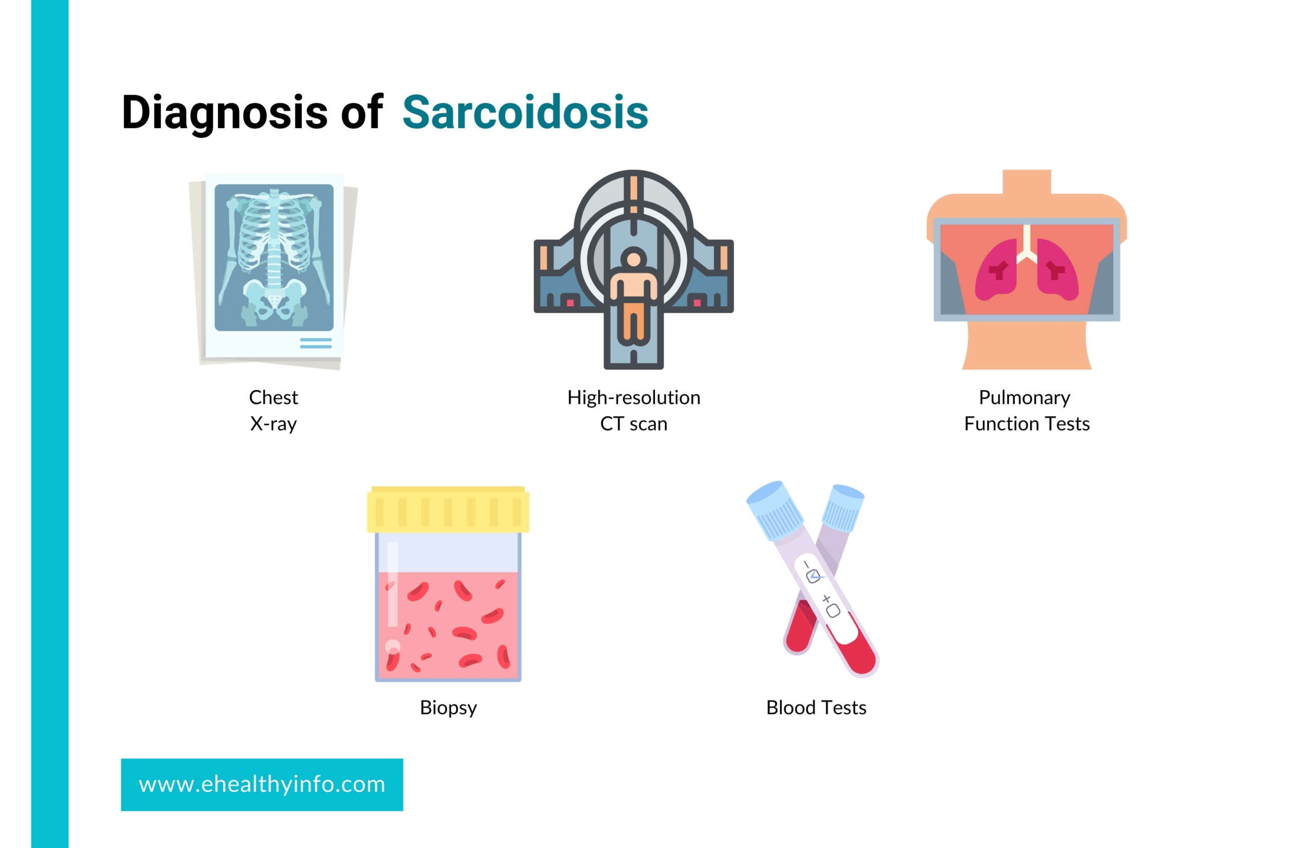 diagnosis of sarcoidosis