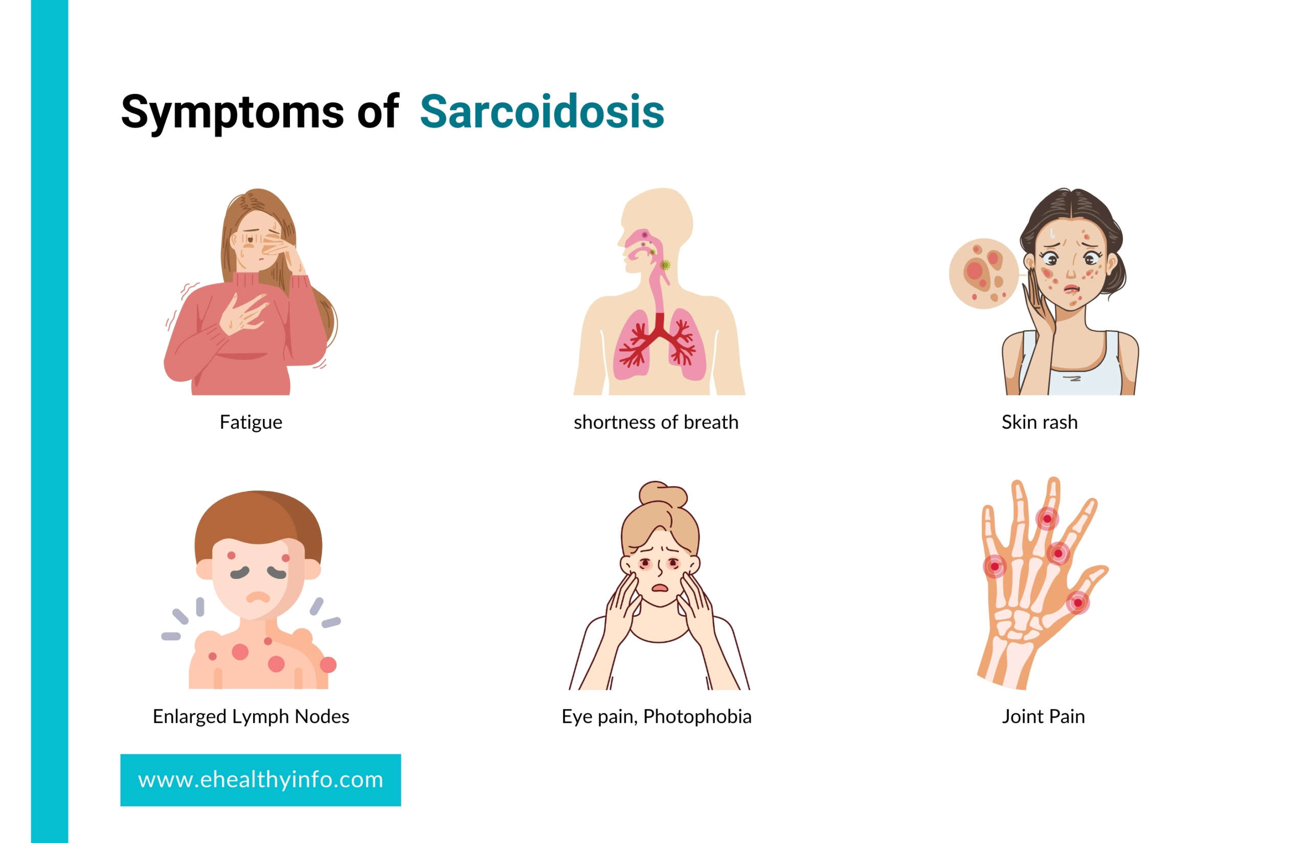 symptoms of sarcoidosis