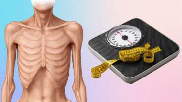 bmi and cancer cachexia