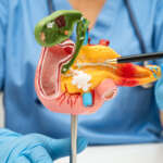 Healthcare professional demonstrating a detailed anatomical pancreas model with a medical pointer during an educational examination