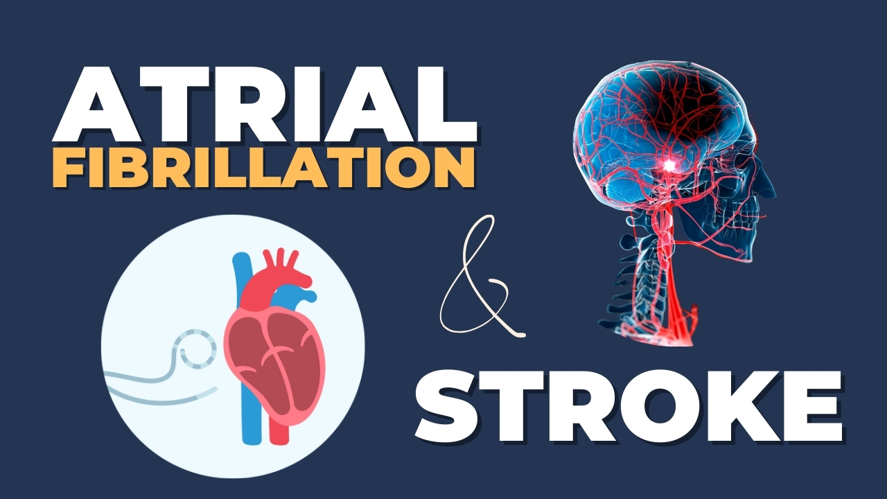 The Silent Risk of Atrial Fibrillation and Stroke