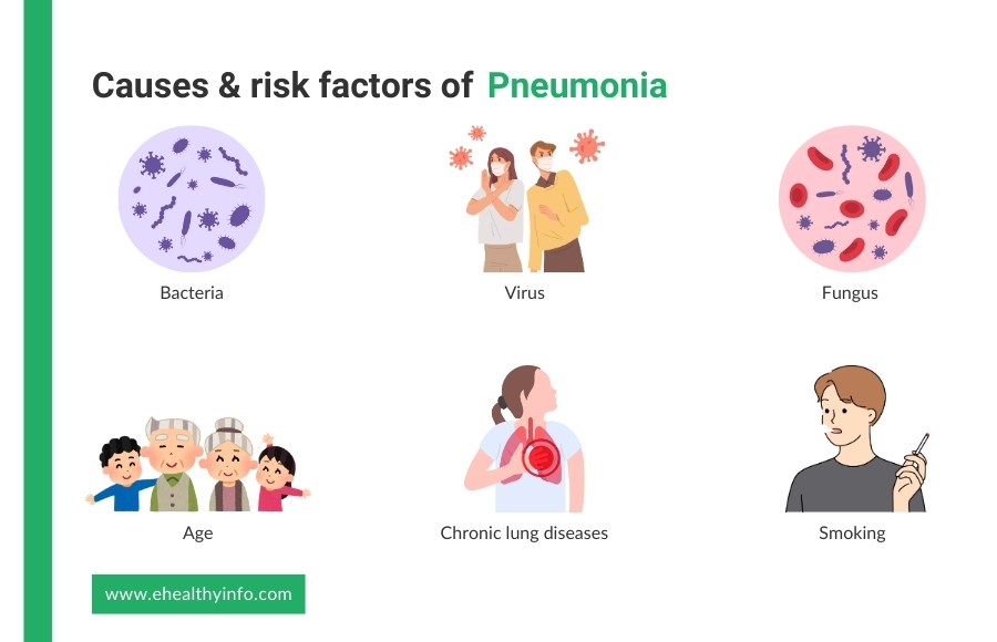 Risk Factors of Pneumonia