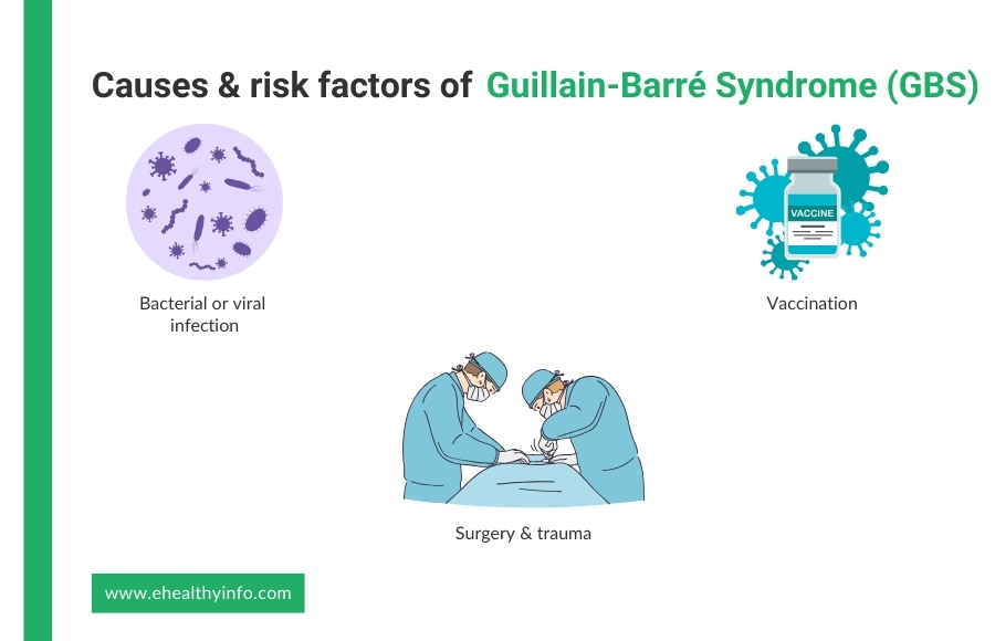 Causes and risk factors of GBS