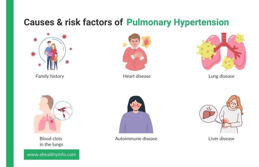 Causes of Pulmonary Hypertension