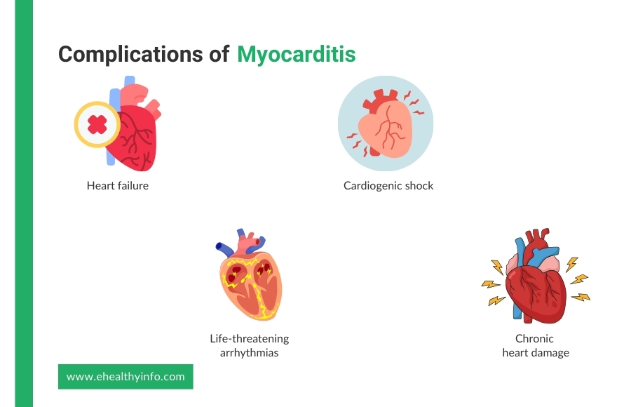 Complications of Myocarditis