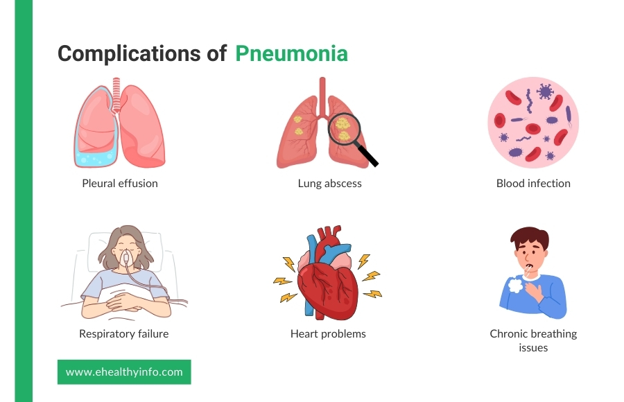 Complications of Pneumonia