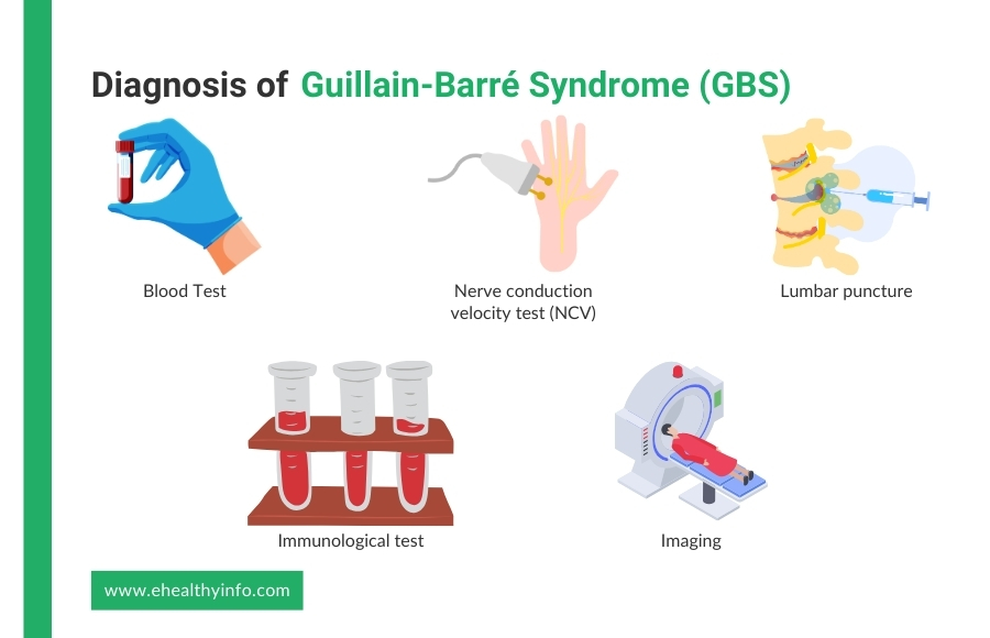 Diagnosis of GBS