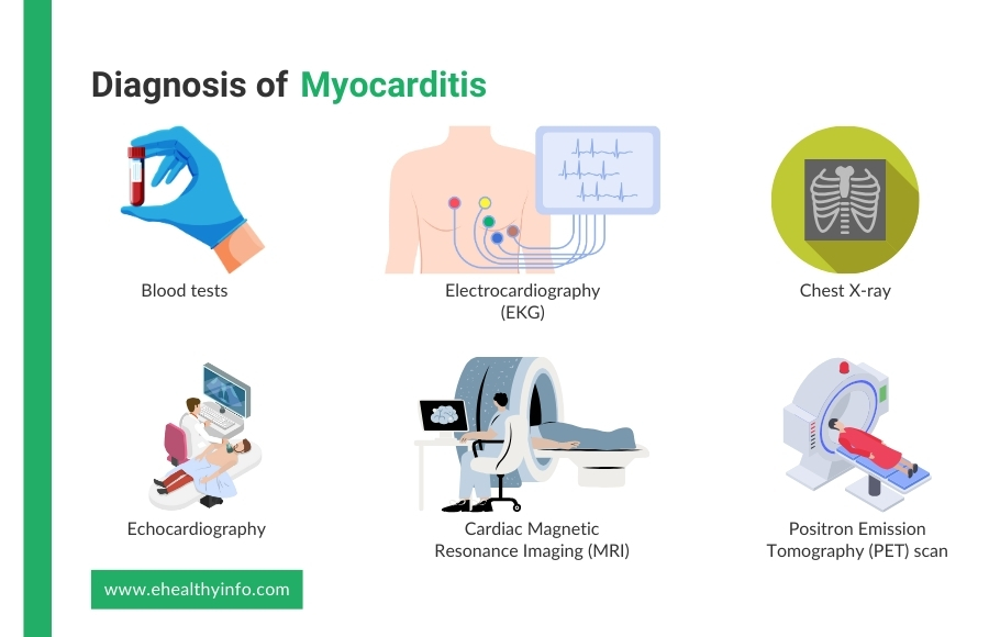 Diagnosis of Myocarditis