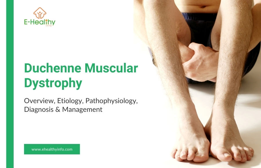 Duchenne Muscular Dystrophy: Unveiling Causes, Symptoms, and Lifesaving Treatments