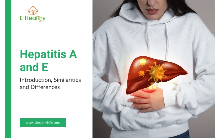 Hepatitis A and E: Introduction, Similarities and Differences