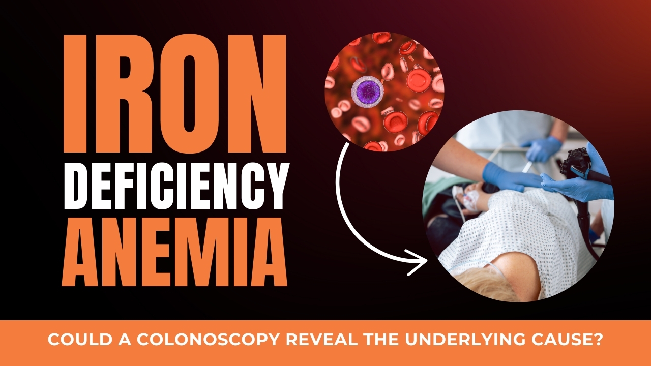 Colonoscopy: Iron Deficiency, Procedure, and Age Guidelines