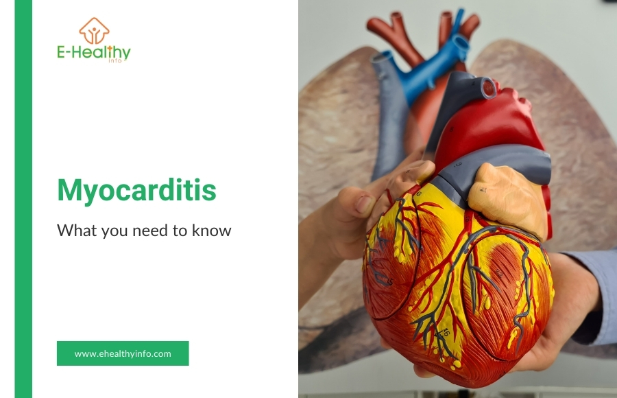 Myocarditis: Causes, Symptoms, and Treatments You Must Know