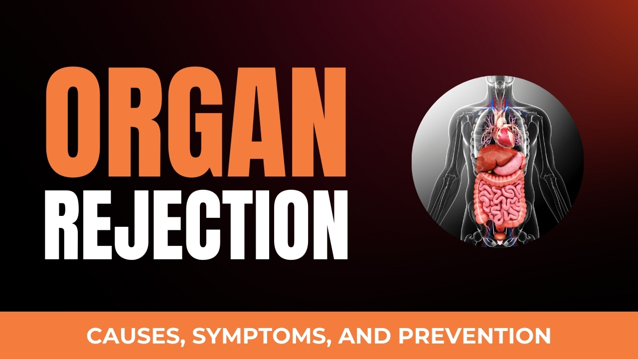 What is Organ Rejection?