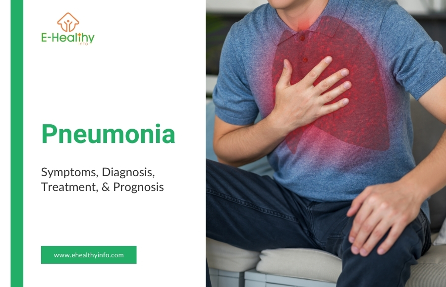 Pneumonia Explained: Symptoms, Causes & Fast Recovery Tips