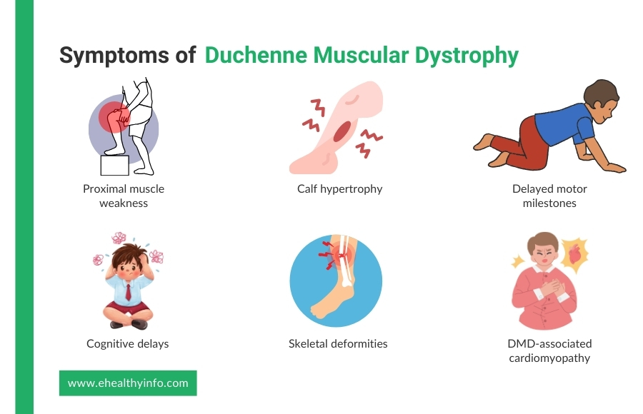 Symptoms of Duchenne Muscular Dystrophy