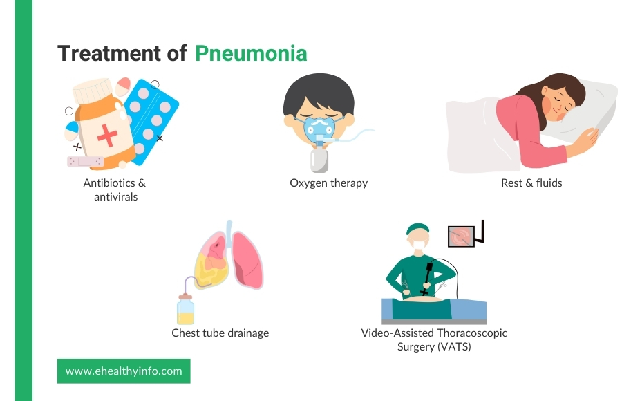 Treatment of Pneumonia